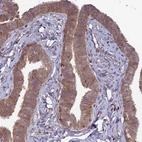 Immunohistochemical staining of human fallopian tube shows moderate cytoplasmic positivity in glandular cells.