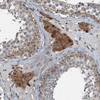 Immunohistochemical staining of human testis shows moderate cytoplasmic positivity in Leydig cells.