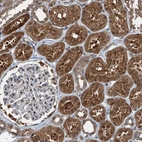 Immunohistochemical staining of human kidney shows strong cytoplasmic positivity in cells in tubules.