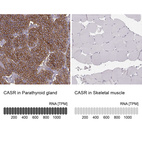 Anti-CASR Antibody