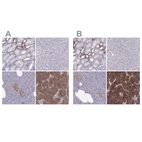 Immunohistochemical staining of human kidney, liver, pancreas and parathyroid gland using Anti-CASR antibody HPA039686 (A) shows similar protein distribution across tissues to independent antibody HPA050335 (B).