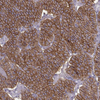 Immunohistochemical staining of human parathyroid gland shows strong membranous positivity in glandular cells.