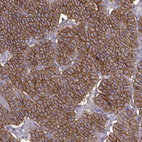 Anti-CASR Antibody