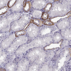 Anti-CASR Antibody