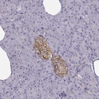 Immunohistochemical staining of human pancreas shows moderate membranous positivity in islets of Langerhans.