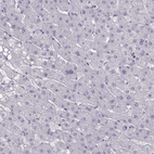 Anti-CASR Antibody