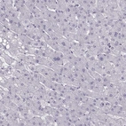 Immunohistochemical staining of human liver shows no positivity in hepatocytes as expected.