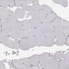 Immunohistochemical staining of human skeletal muscle shows no positivity in myocytes as expected.
