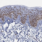 Immunohistochemical staining of human skin shows strong nuclear positivity in squamous epithelial cells.