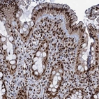 Immunohistochemical staining of human rectum shows strong nuclear positivity in glandular cells.