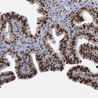 Immunohistochemical staining of human fallopian tube shows strong nuclear positivity in glandular cells.