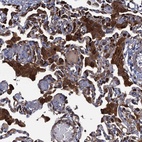 Anti-DNHD1 Antibody