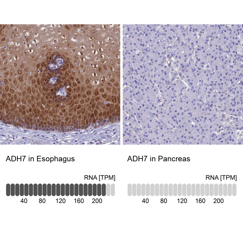Anti-ADH7 Antibody