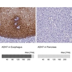 Anti-ADH7 Antibody