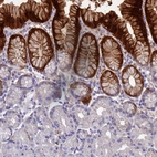 Immunohistochemical staining of human stomach shows strong cytoplasmic positivity in glandular cells.
