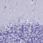 Immunohistochemical staining of human cerebellum shows no positivity as expected.