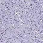 Immunohistochemical staining of human pancreas shows no positivity in exocrine glandular cells as expected.