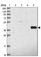 Lane 1: Marker [kDa] 250, 130, 95, 72, 55, 36, 28, 17, 10_br/_Lane 2: Human cell line RT-4_br/_Lane 3: Human cell line U-251MG sp_br/_Lane 4: Human plasma (IgG/HSA depleted)_br/_Lane 5: Human liver tissue