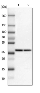 Lane 1: Mouse liver tissue lysate_br/_Lane 2: Rat liver tissue lysate