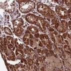 Anti-RNF17 Antibody