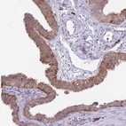 Anti-EXOSC8 Antibody