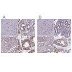 Anti-MPHOSPH8 Antibody