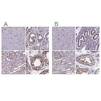 Anti-MPHOSPH8 Antibody