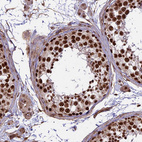 Immunohistochemical staining of human testis shows strong nuclear positivity in cells in seminiferous ducts.