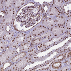 Immunohistochemical staining of human kidney shows moderate to strong nuclear positivity in cells in tubules.