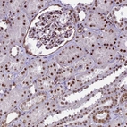 Immunohistochemical staining of human kidney shows moderate to strong nuclear positivity in cells in tubules.