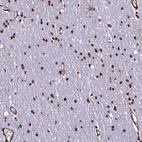 Immunohistochemical staining of human cerebral cortex shows strong nuclear positivity in glial cells.