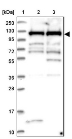 Lane 1: Marker [kDa] 250, 130, 95, 72, 55, 36, 28, 17, 10_br/_Lane 2: Human cell line RT-4_br/_Lane 3: Human cell line U-251MG sp