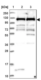 Lane 1: Marker [kDa] 250, 130, 95, 72, 55, 36, 28, 17, 10_br/_Lane 2: Human cell line RT-4_br/_Lane 3: Human cell line U-251MG sp