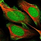 Immunofluorescent staining of human cell line U-2 OS shows localization to nucleus, nucleoli & plasma membrane.
