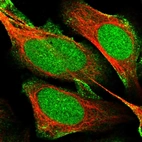 Immunofluorescent staining of human cell line U-2 OS shows localization to nucleus, nucleoli & plasma membrane.