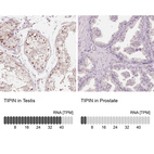 Anti-TIPIN Antibody