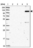 Lane 1: Marker [kDa] 250, 130, 95, 72, 55, 36, 28, 17, 10_br/_Lane 2: Human cell line RT-4_br/_Lane 3: Human cell line U-251MG sp_br/_Lane 4: Human plasma (IgG/HSA depleted)_br/_Lane 5: Human liver tissue