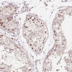Immunohistochemical staining of human testis shows high expression.