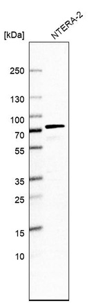 Western blot analysis in human cell line NTERA-2.