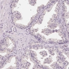 Immunohistochemical staining of human prostate shows low expression as expected.