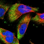 Immunofluorescent staining of human cell line U-251 MG shows localization to cytosol.