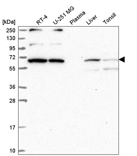 Anti-WBP11 Antibody