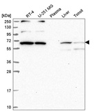 Anti-WBP11 Antibody