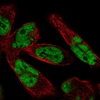 Anti-WBP11 Antibody