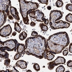 Immunohistochemical staining of human placenta shows strong membranous and cytoplasmic positivity in trophoblastic cells.