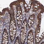 Immunohistochemical staining of human colon shows strong membranous and cytoplasmic positivity in glandular cells.