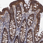 Immunohistochemical staining of human colon shows strong membranous and cytoplasmic positivity in glandular cells.