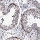 Immunohistochemical staining of human testis shows strong membranous and cytoplasmic positivity in spermatogonia.