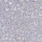 Immunohistochemical staining of human liver shows negative to very weak cytoplasmic positivity in hepatocytes.