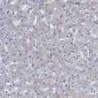Immunohistochemical staining of human liver shows negative to very weak cytoplasmic positivity in hepatocytes.
